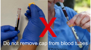 Do not remove caps from tubes 20240628 FG - copy2.png