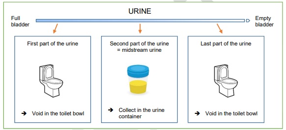 Urine.jpg